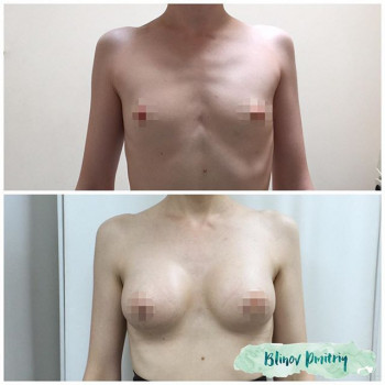 Дмитрий Блинов , Moscow Фото - 6