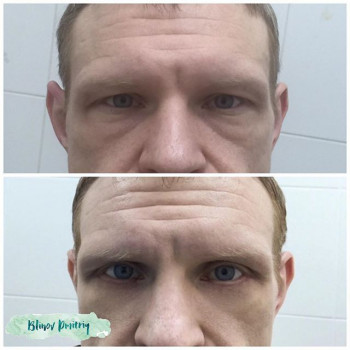 Дмитрий Блинов , Moscow Фото - 7