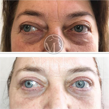 Иван Майский , Moscow Фото - 6