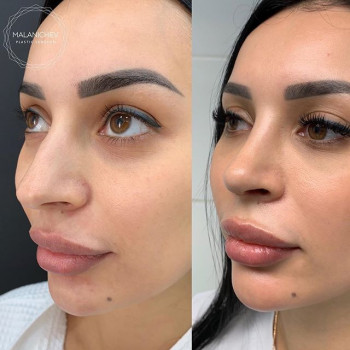 Михаил Маланичев , Moscow Фото - 5