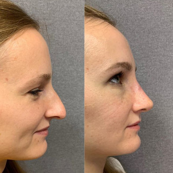 Салим Рагимов , Москва Фото - 5