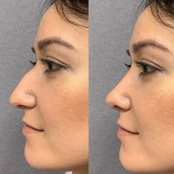 Салим Рагимов , Москва Фото - 6