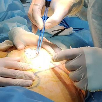 Олег Ведров , Moscow Фото - 6