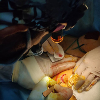 Олег Ведров , Moscow Фото - 7