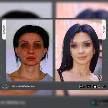 Геворг Степанян , Moscow Фото - 5