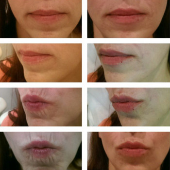 Айнутдин Гамидов , Moscow Фото - 5