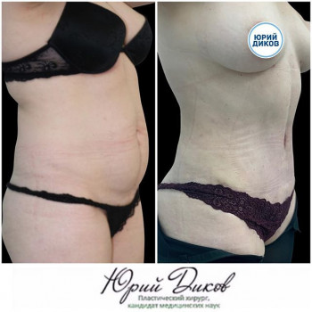 Юрий Диков , Moscow Фото - 5