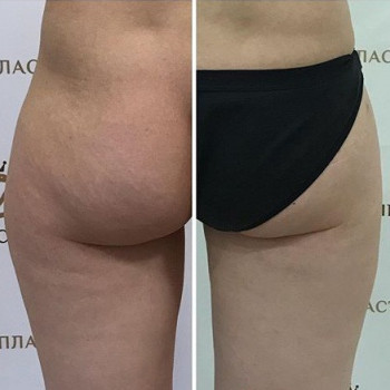 Михаил Щепелин , Moscow Фото - 5