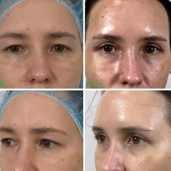 Михаил Щепелин , Moscow Фото - 6