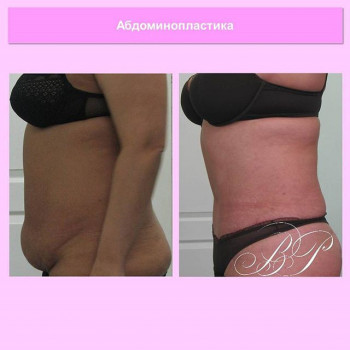 Валерия Гохман , Moscow Фото - 6