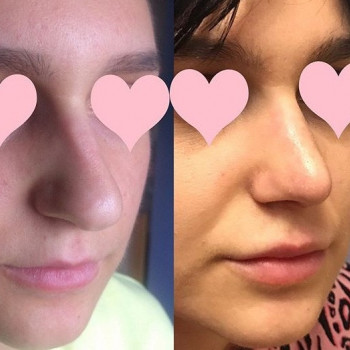 Татьяна Мирошниченко , Moscow Фото - 5