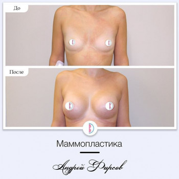 Андрей Фирсов , Moscow Фото - 5