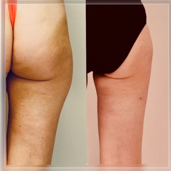 Полина Соболева , Moscow Фото - 5