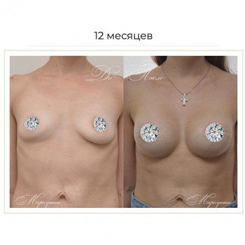 Александр Маркушин , Moscow Фото - 5