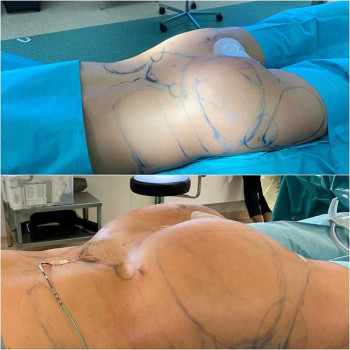 Дмитрий Мельников , Moscow Фото - 7