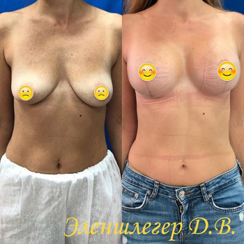 Дмитрий Эленшлегер , Moscow Фото - 5