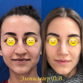 Дмитрий Эленшлегер , Moscow Фото - 6