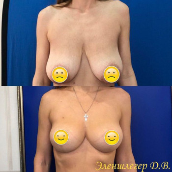 Дмитрий Эленшлегер , Moscow Фото - 7