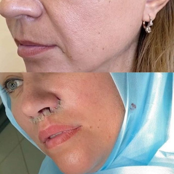 Зулихан Висаитова , Moscow Фото - 5