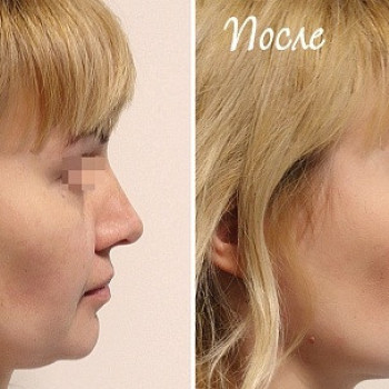 Валентин Шаробаро , Moscow Фото - 6