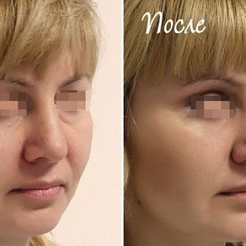 Валентин Шаробаро , Moscow Фото - 7