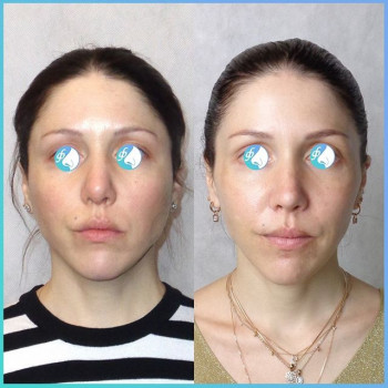 Иван Фетисов , Moscow Фото - 5