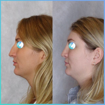 Иван Фетисов , Moscow Фото - 6