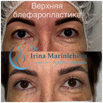 Ирина Мариничева, Moscow Фото - 5