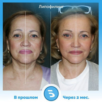 Олег Берлев , Москва Фото - 7