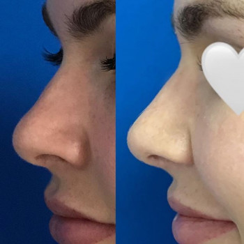 Вартан Азнаурян , Moscow Фото - 5