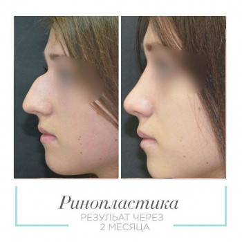 Тигран Алексанян , Moscow Фото - 8