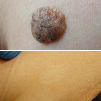 Александр Полев , Moscow Фото - 5