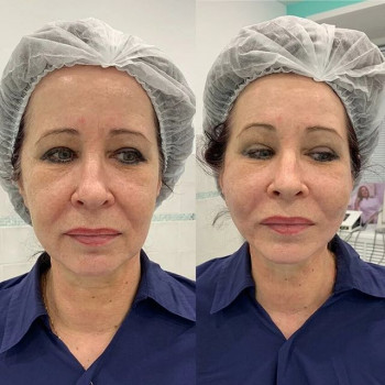 София Крихели, Moscow Фото - 5