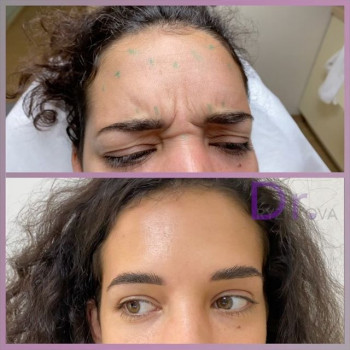 Ольга Рыжкова , Moscow Фото - 5