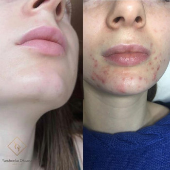 Оксана Юрченко , Москва Фото - 5