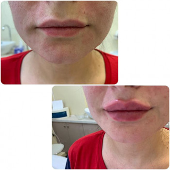 Эльмира Мустафаева , Москва Фото - 5