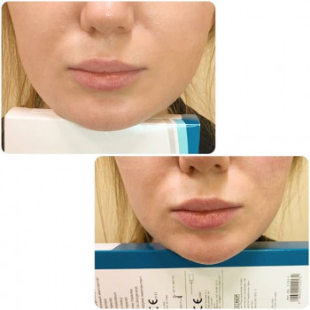 Эльмира Мустафаева , Москва Фото - 6