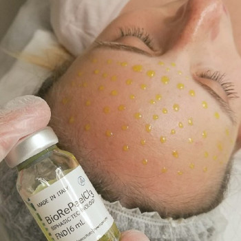 Эльмира Мустафаева , Москва Фото - 7