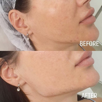 Яна Кабанова , Moscow Фото - 5