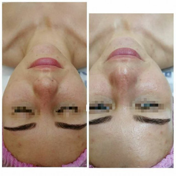 Анна Ковалева , Moscow Фото - 6