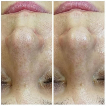 Анна Ковалева , Moscow Фото - 7