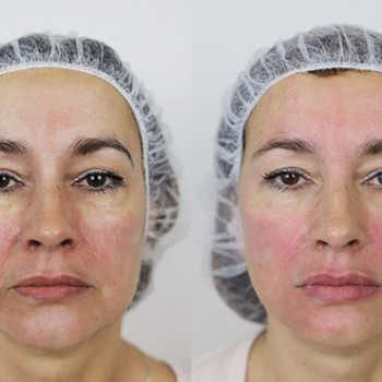 Елизавета Бебурова , Moscow Фото - 5