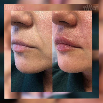 Ильмира Ханова , Moscow Фото - 5