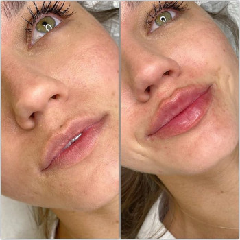 Надежда Карпова , Moscow Фото - 5