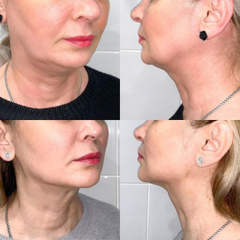 Нелли Гулам , Москва Фото - 5