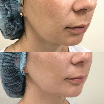 Элина Хасиева , Moscow Фото - 5