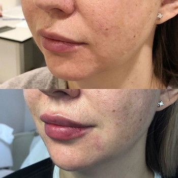 Элина Хасиева , Moscow Фото - 6