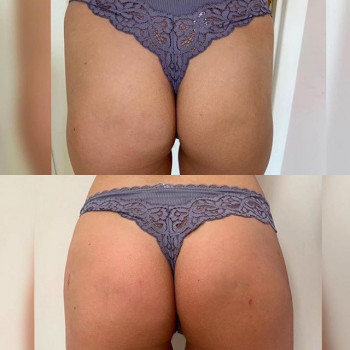 Екатерина Пантелеева , Moscow Фото - 5