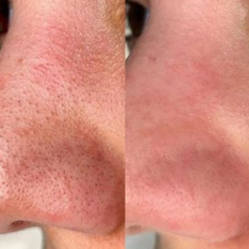 Яна Смирнова , Moscow Фото - 5