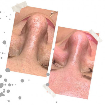 Евгения Ряпосова , Moscow Фото - 5